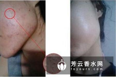 冬季怎么快速吹干?要一次吹干吗:冬季怎么吹干吗?养生频道