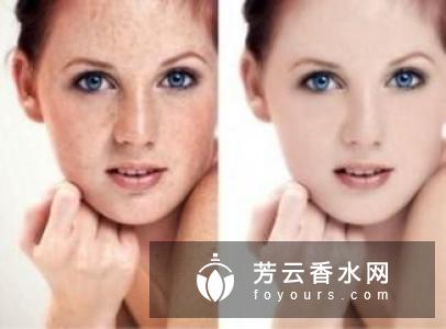 眼角长雀斑是什么原因 怎么办