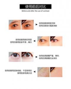 潘达眼膜要洗吗 可以敷多久