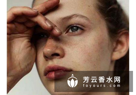 眼角长雀斑是什么原因 怎么办