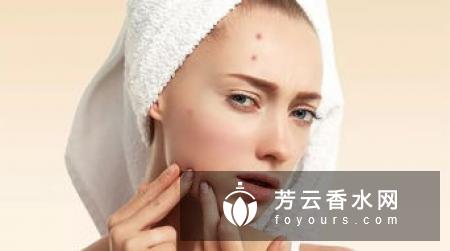 痘痘贴有危害吗 错误的使用方法是怎样的