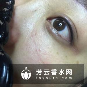 美瞳线应该纹在哪里 哪些人适合做
