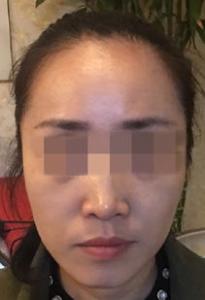 减肥腰带的好处有哪些 可以丰胸吗