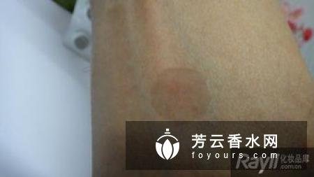 痘痘贴是挤后再用吗