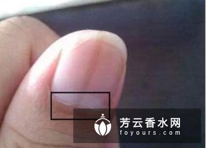 卸甲水含甲醛成分吗?对指甲有危害吗