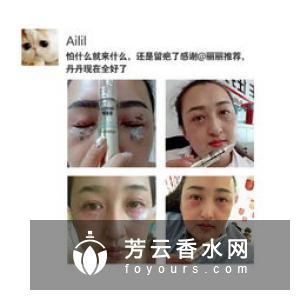 ISDIN怡思丁是哪个国家的 祛疤效果怎么样