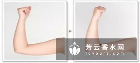 手臂抽脂会反弹吗 多久恢复正常