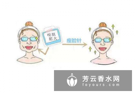 咬肌肥大是天生的吗?怎么减掉?