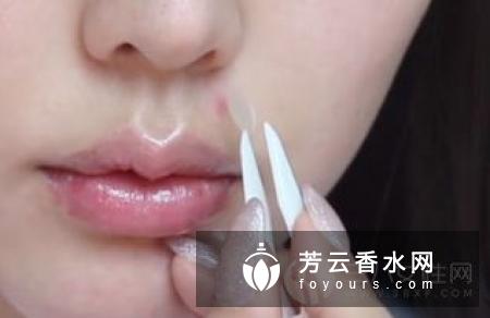 痘痘贴是挤后再用吗