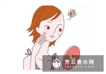 脸上痘痘抠破了怎么办 长脓后的注意事项
