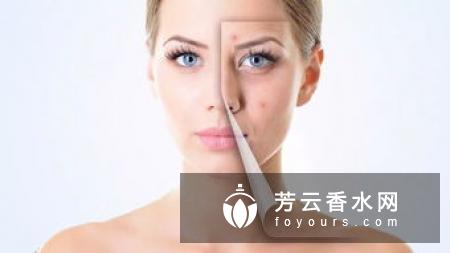 激光美容仪适合疤痕体质吗 会留疤吗