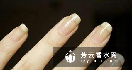 美甲发黄怎么办?
