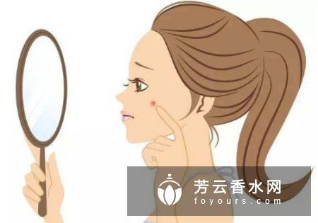太阳穴长痘痘是什么原因 怎么办