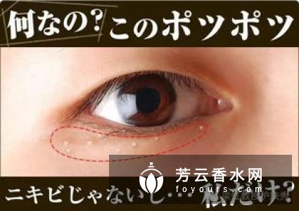 眼角长了一个白色颗粒是什么 眼霜用太多会长脂肪粒吗