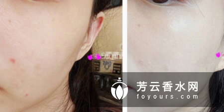 蒂佳婷银管使用方法 适合什么肤质